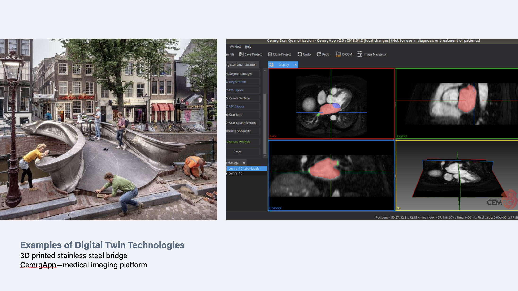 Two example images of digital twins: Amsterdam's 3D printed steel bridge with sensors and CemrgApp - an interactive medical imaging platform for cardiac diseases